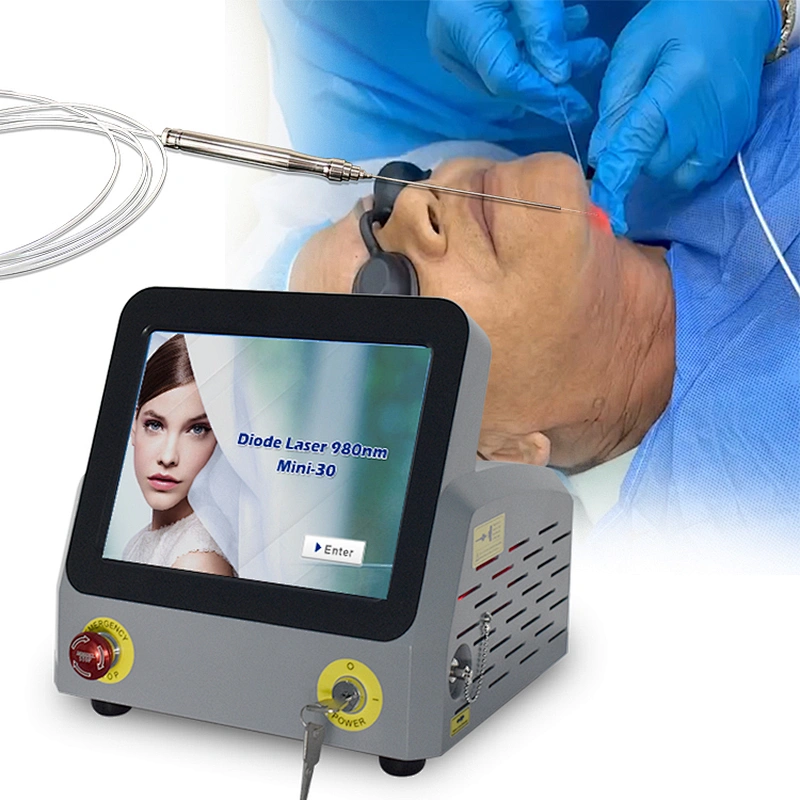 Triangel Laser Diode Laser Liposuction for Double Chin 980nm Endolaser Lipolysis Liposuction Machine