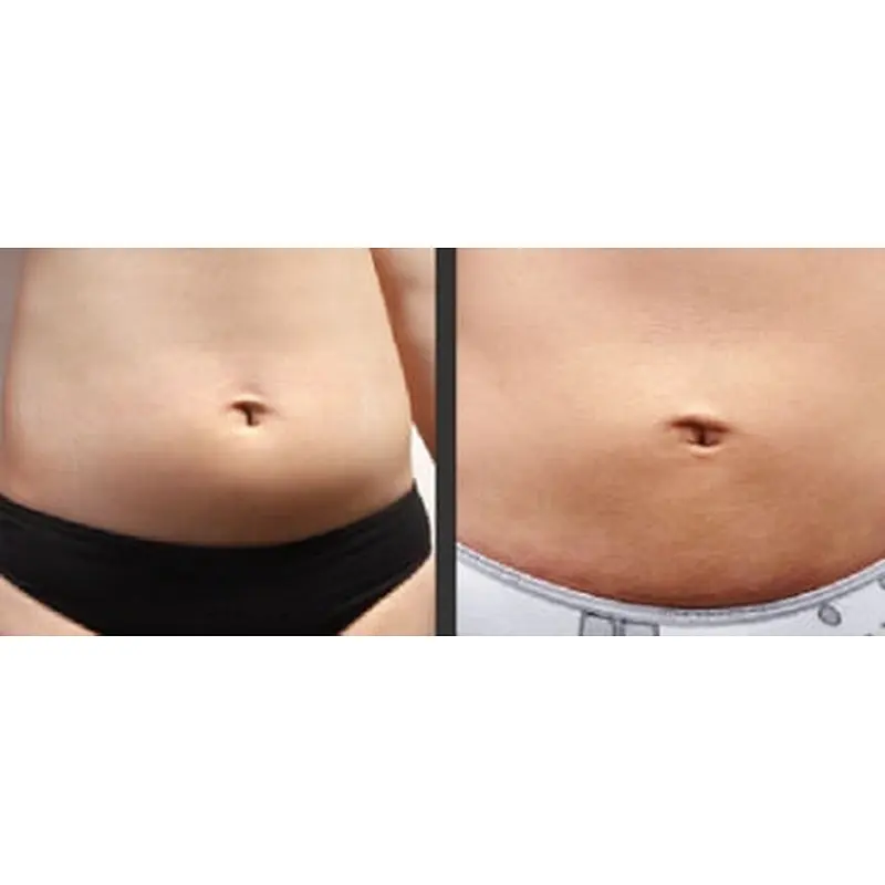 New Arrival Italy 1470nm 15W 30W Endolaser Liposuction Lipolysis Machine