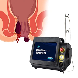 High Quality Chinese Manufacturer Anorectal Laser 980nm 1470nm Hemorrhoid Intestinal Hair Sinusiostomy Machine