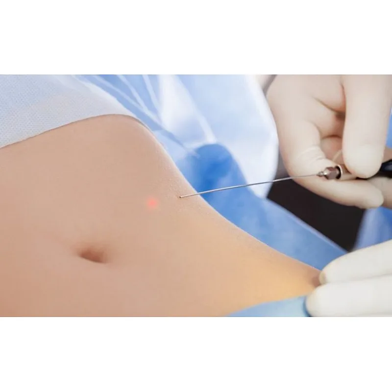 Triangel Laseev Portable Lipolysis Endolaser Slimming Fat Removal Liposuction Machine for Sale Diode Laser 980nm+1470nm