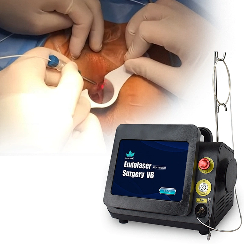Multifunctional Design 980nm 1470nm Diode Laser Proctology Surgery Laser Machine