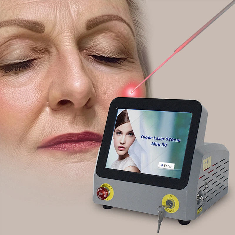 Face Lifting Liposuction 980nm Endolaser