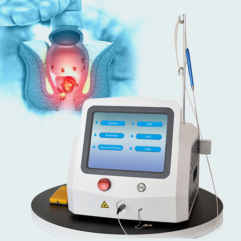 Medical CE Authentication Diode Laser Treat Hemorrhoids Surgery Machine 980nm1470nm Cutting Hemorrhoids/Anal Fistula