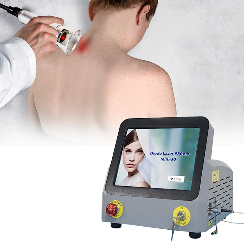 Portable 980nm Pain Relief 980nm Therapy Laser Class 4 Laser Therapy Machine Deep Tissue Laser Therapy
