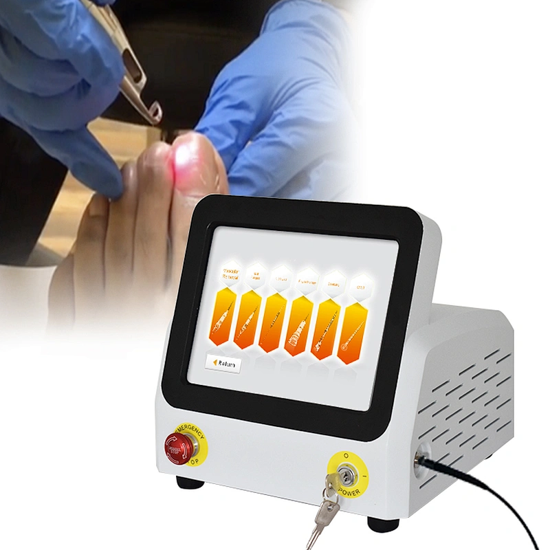 Hot Sale Class IV Laser for Nail Fungus Treatment Medical Equipment Podiatry Nail Fungus Onychomycosis Laser Podiatry Laser