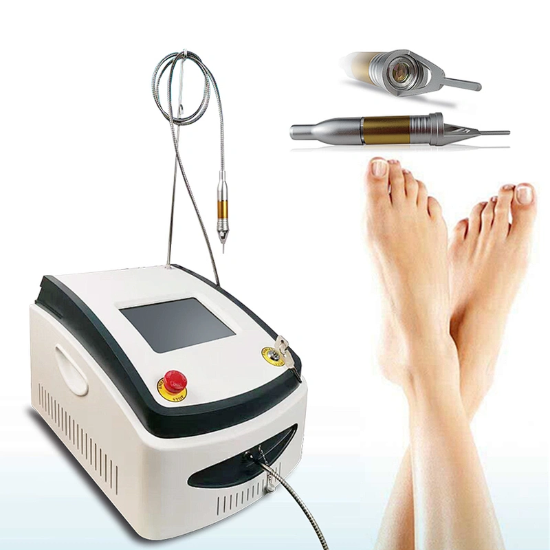 980nm Diode Laser Onychomycosis Nail Fungus Treatment Laser Onychomycosis Removal  Device