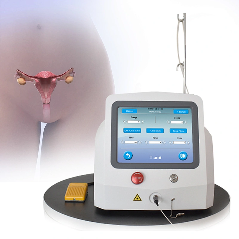Portable Gynecology Vaginal Tightening Surgery Laser System Vaginal Rejuvenation Laser Machine