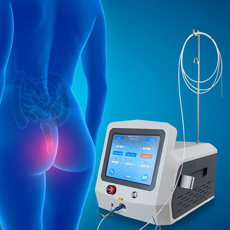 Anal Fistula Internal External Hemorrhoids Remover Piles Laser Radial Fiber 980nm 1470nm Piles Surgical Laser Instrument