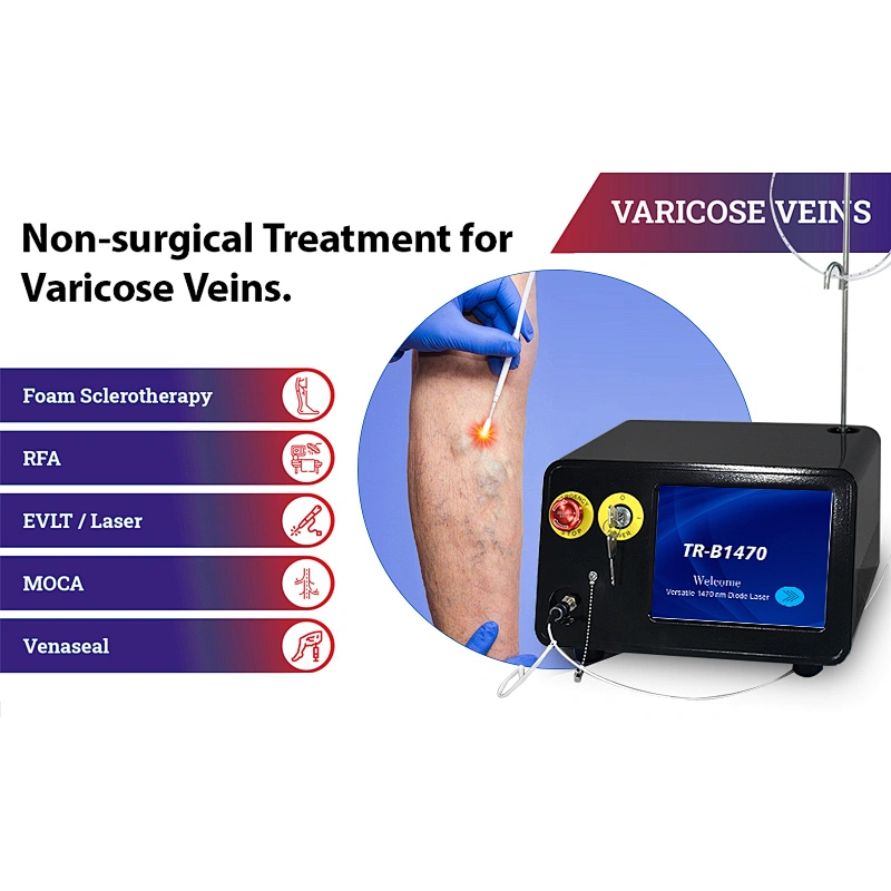 Latest Surgery 1470nm 15W Laser EVLT Treatment Varicous Veins Spider Veins Machine