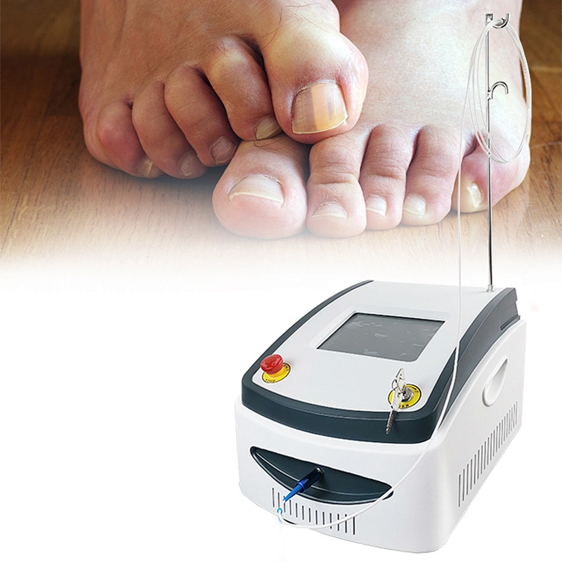 Laser Podiatry Onychomycosis Nail Fungus Treatment Diode Laser 1064 980 nm Fungal Nail Laser Machine