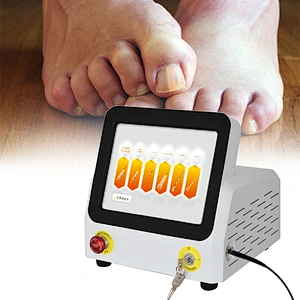 Professional Portable 980nm Class IV Diode Laser Therapy Equipment /nail Fungus/Onychomycosis