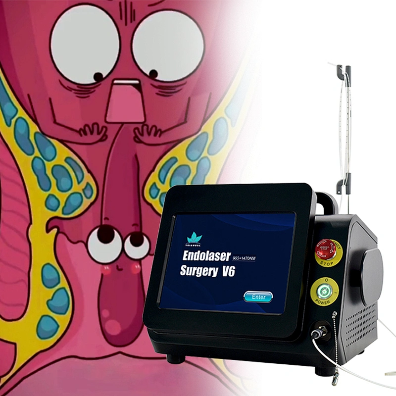 Hemorrhoids removal 980nm 1470nm diode laser machine treatment of hemorrhoids fistulas