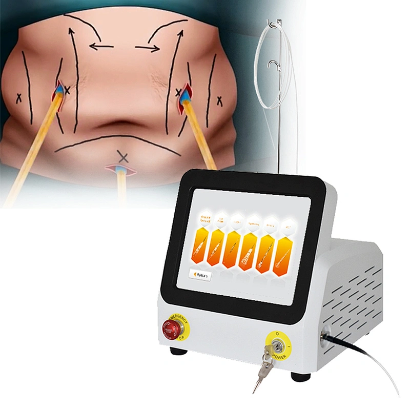 Vaser Liposuction Lipolysis Body Fat Equipment Diode Laser 980nm Body Shaping Slimming Machine