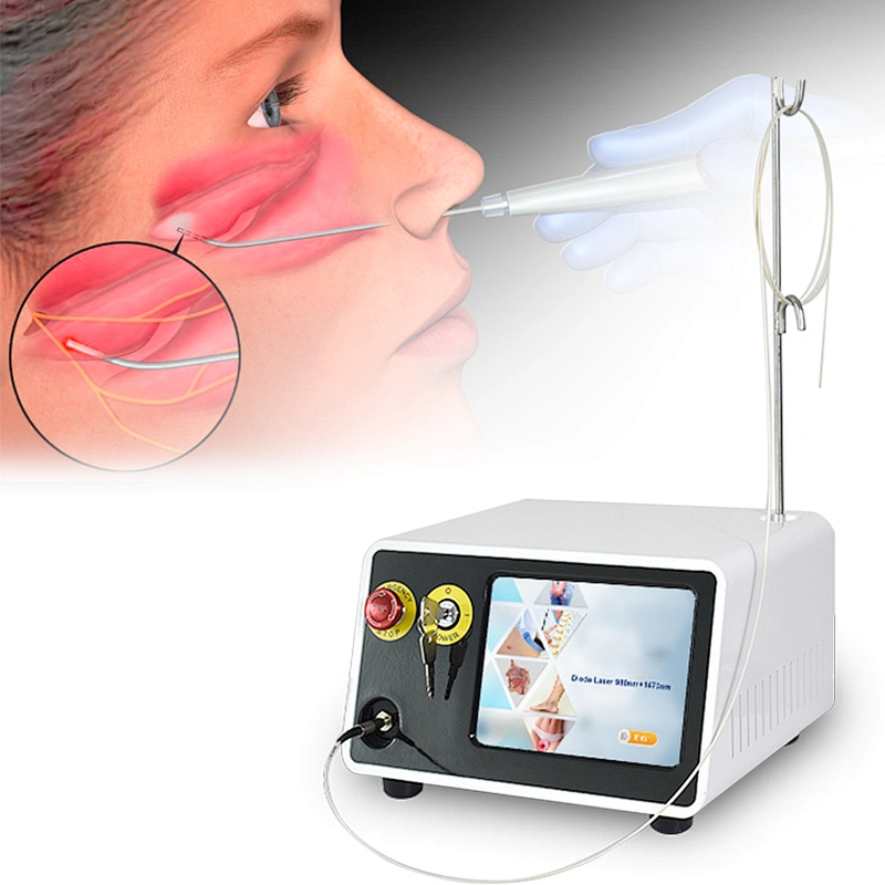 Non Invasive Otolaryngologist Ear Nose Throat OralSurgery Laser Device