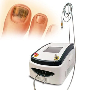 980nm Nail Fungus Diode Laser Machine Treatment Onychomycosis Nail Fungus Podiatry Plantar Warts Onychomycosis