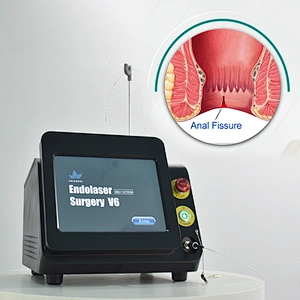 980nm1470nm Proctology Surgical Treatment Machine High Power Removal Fistula Hemorrhoids Pilonidal Sinus