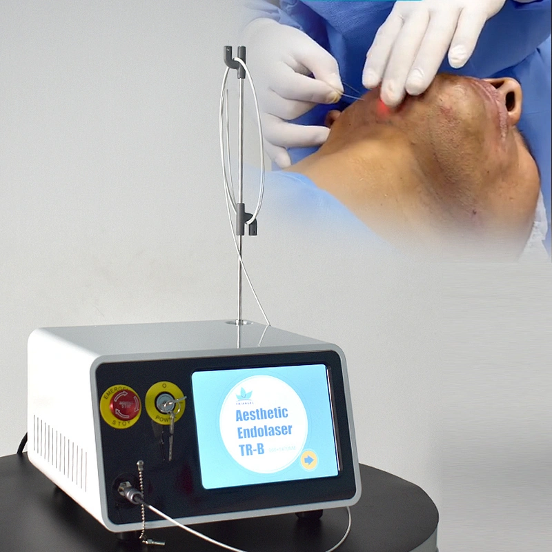 Vaser 980nm 1470nm Diode Laser Liposuction / Lipolysis  Remove Papada and Endolaser Facial Lifting