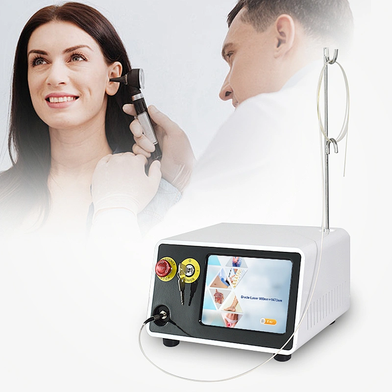 Non Invasive Otolaryngologist Ear Nose Throat OralSurgery Laser Device