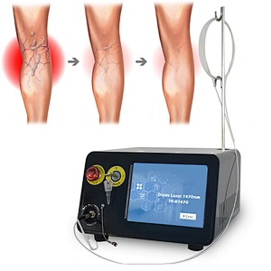 Multiple Function1470nm Pain Free High Radio Frequency Vascular Spider Vein Removal Treatment Laser Blood Vessel Removal Machine