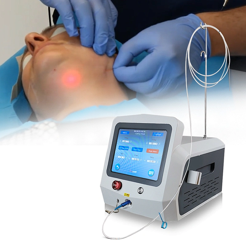 Hot Sell Surgery Dual-Wavelength Laser 980nm+1470nm Skin Lift Liposuction Fat Ablation Laser Machine Lipolysis