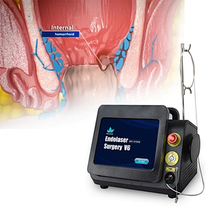 Diode Laser Dual 980nm 1470nm Hemorrhoidectomy Laser for Proctologist/Proctology