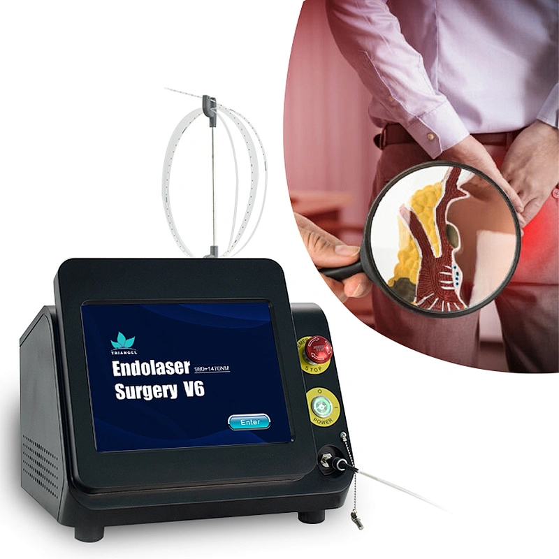2024 Best Sell Diode Laser 980 1470 nm for Hemorrhoid Laser Diodo Hemorroides