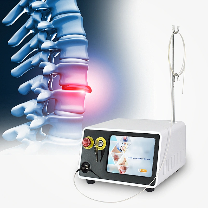 Class IV 2024 New Design 980nm/1470nm Diode Laser PLDD Treatment Machine