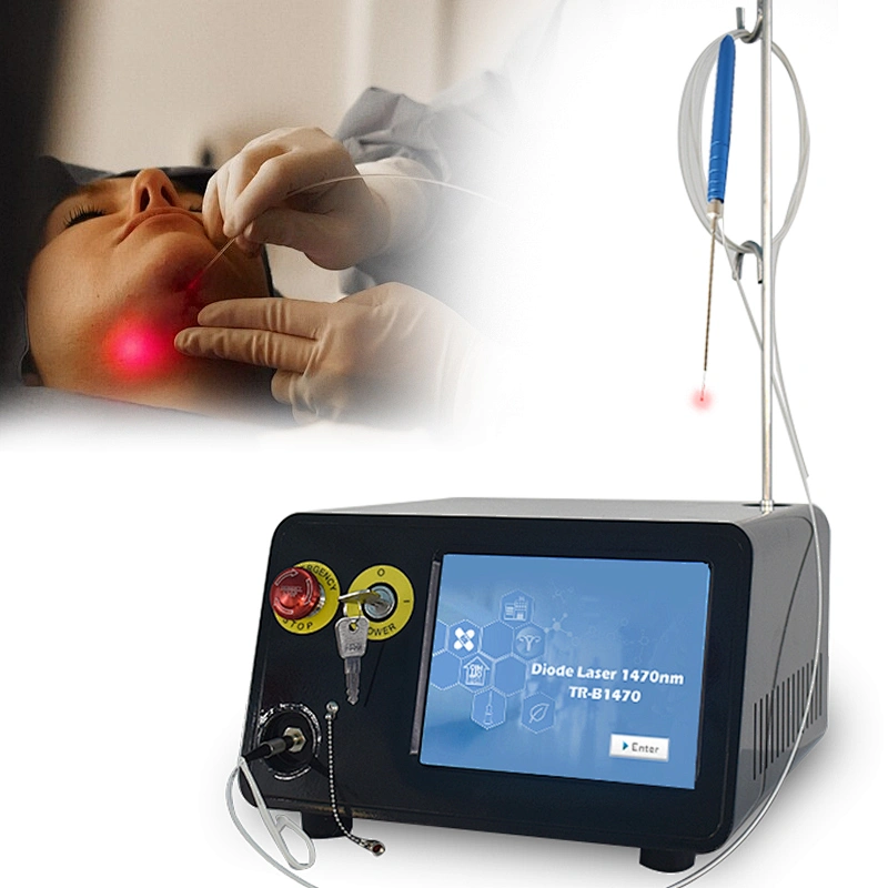 2025 Newest Liposuction Machine 980nm 1470nm Diode Laser Endolaser Facial Lifting