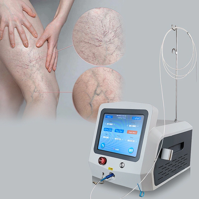 4 in 1 980nm Laser Spider Vein Diodo Laser Endovascular Laser Endovenous Machine Radiofrequency Varicose Veins Removal Machine