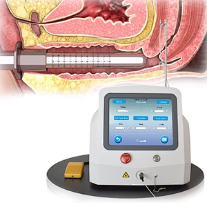 980nm1470nm Diode Laser Vaginal Tightening Gynecology Tightener Machine Vagina Eliminate Vaginal Odor and Itching Vagina Massage