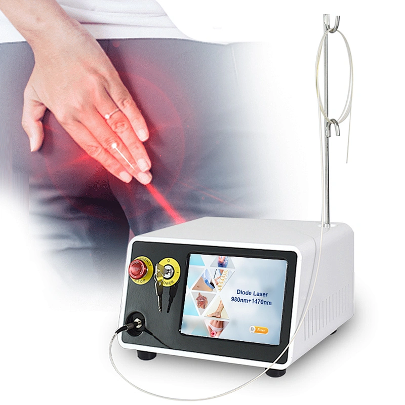 2025 New Hemorrhoid Treatment Surgery Laser Diode 980nm 1470nm Piles and Hemorrhoids Surgical Laser Device