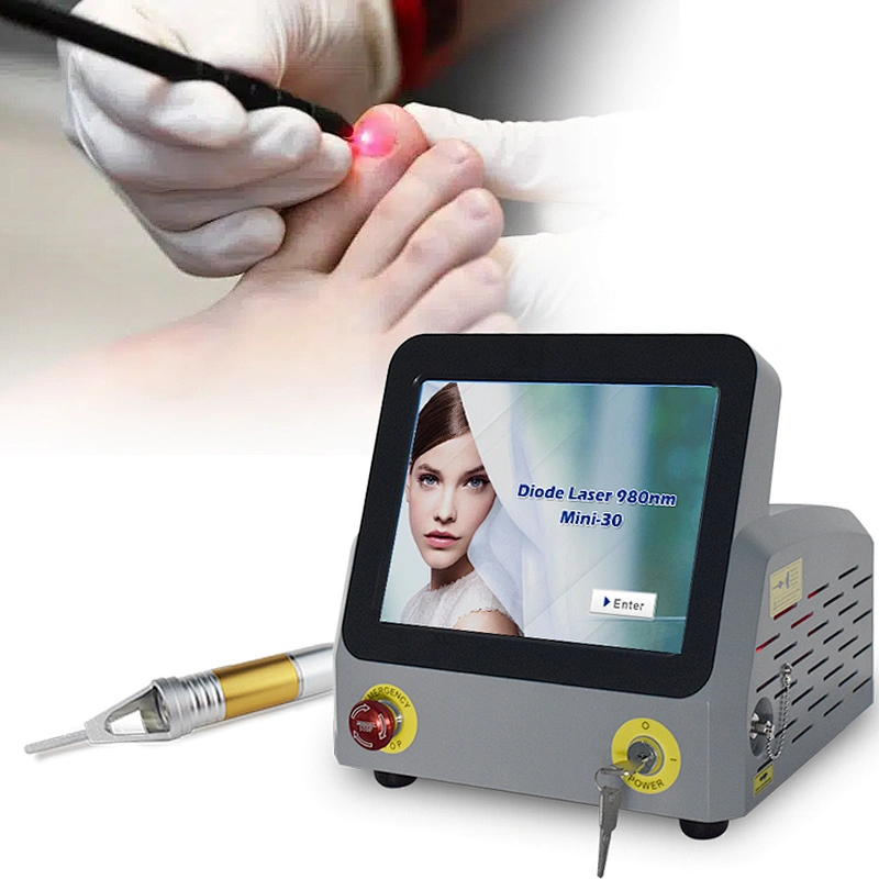 Best 4 In1 Class IV Diode Vascular Laser 980 for Chronic Pain Cold Laser Therapy Machine Onychomycosis Laser Nail Fungus