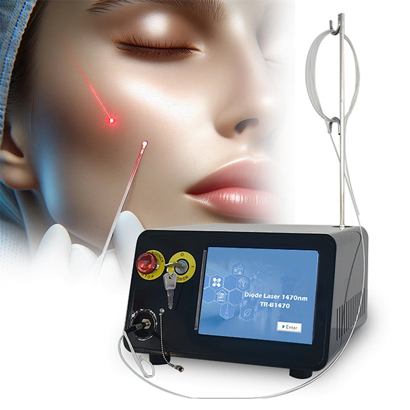 Factory Supply Best Quality Liposuction Lipolysis Endolaser Fat Reduction Skin Rejuvenation Face Lifting Laser 1470nm