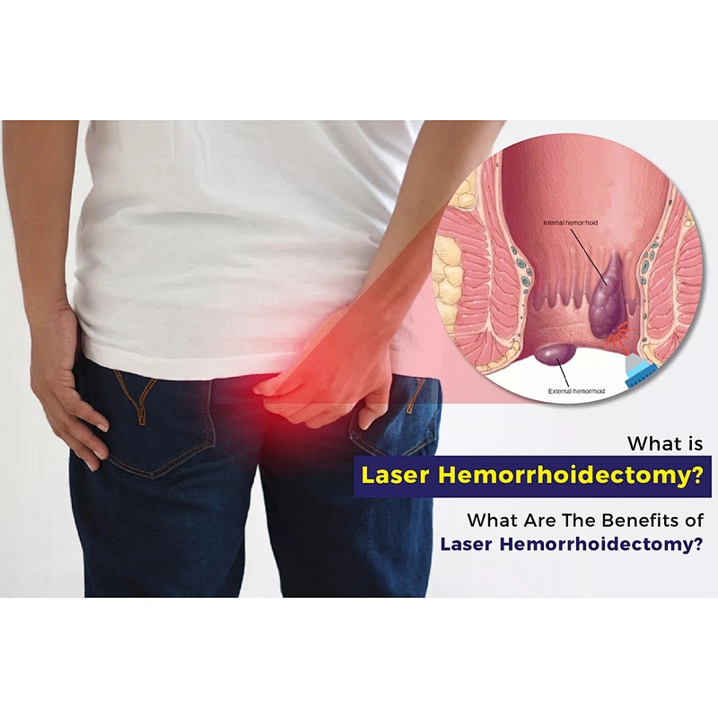 2023 Diode Laser Surgery Proctology Hemorrhoids Cutting  Diode Laser 980nm 1470nm Machine