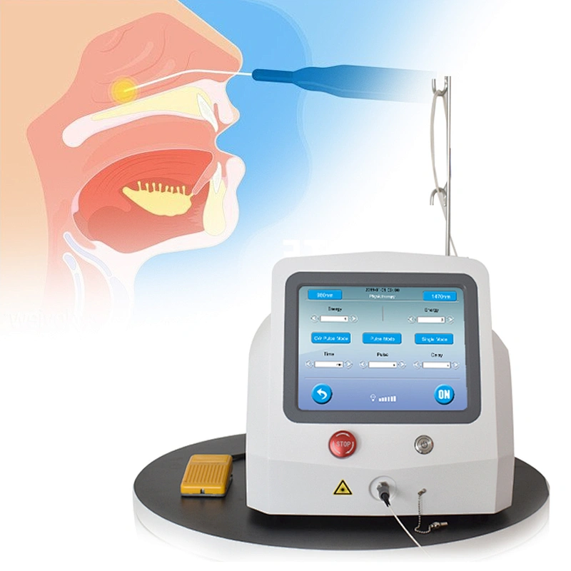 New High Quality Medical Equipment ENT Diode Laser 980nm 1470nm ENT Surgical Treatment Machine