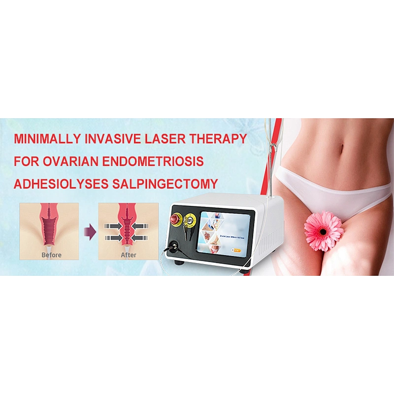 Laser Vaginal Rejuvenation Laser Therapy Wand Vaginal Tightening Rejuvenation Diode Laser 980nm 1470nm