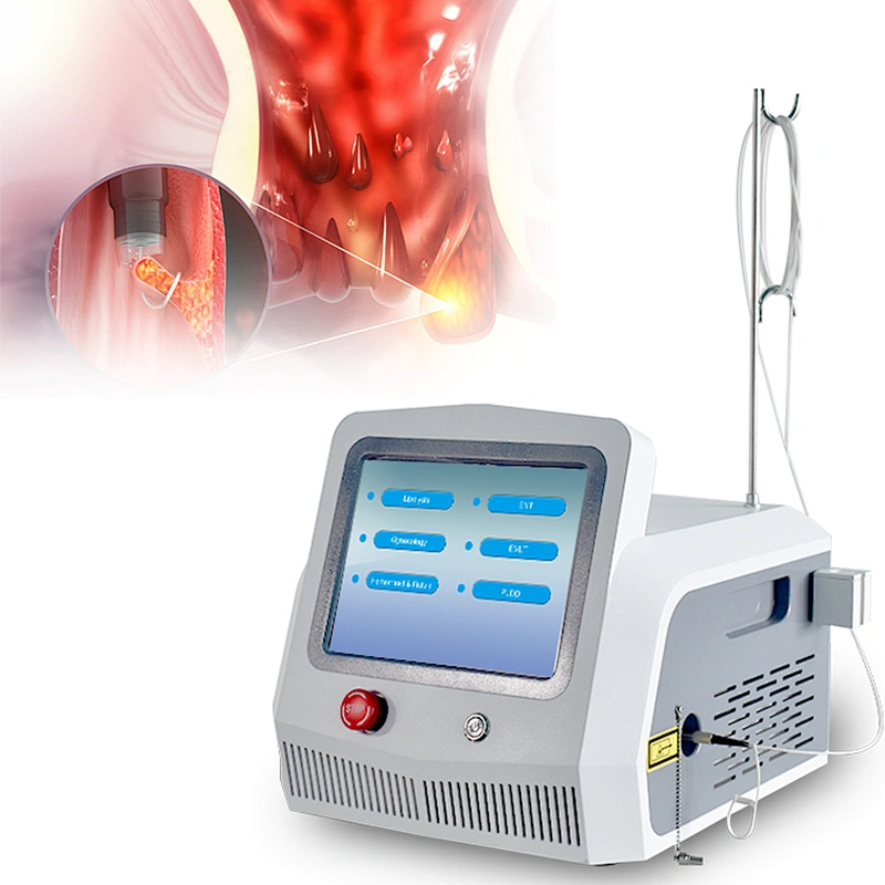2025 Newest 980nm+1470nm Diode Laser Proctology Treatment Device Removal Hemorrhoids Anal Fistula