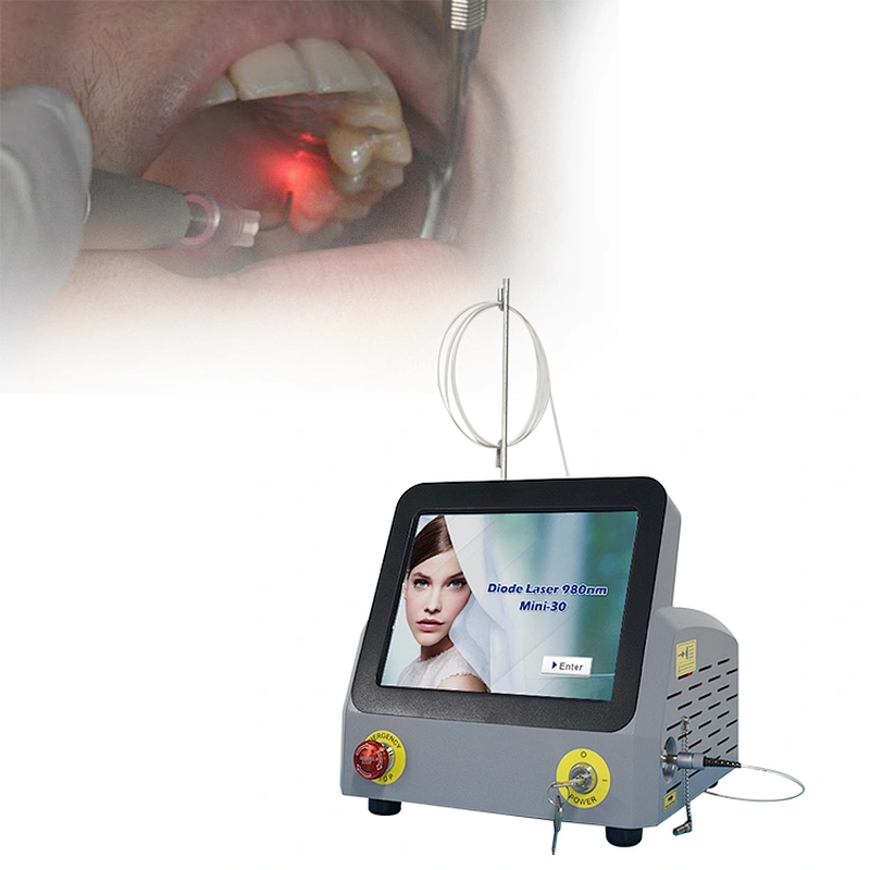 Portable Single Wavelengths 980nm Dentistry Remove Tooth Decay Whitening Laser Treatment Machine