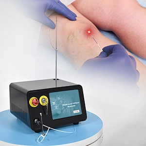 2024 Best Price 1470nm  Diode Laserlaser Varicose Leg Veins Removal Machine for Blood Vessel Wall Burning