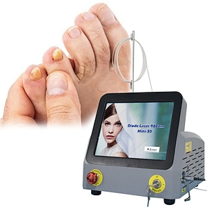 Portable High Power 980nm 30W Diode Laser Remove Nail Fungus Podiatry Onychomycosis Treatment Machine