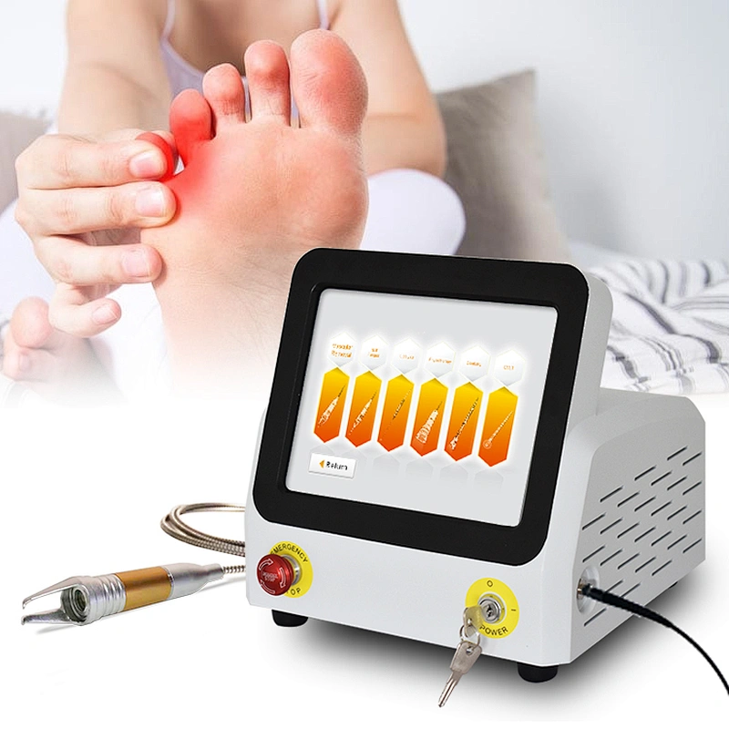 Medical Instrument  60W 980nm Diode Laser Fungal Nail Class IV Laser Podiatry   Nail Fungus Treatment Machine