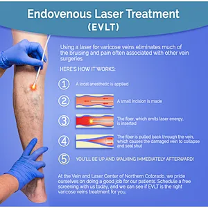 The Newest 980nm Laser  Varicose Veins EVLT EVLA Machine