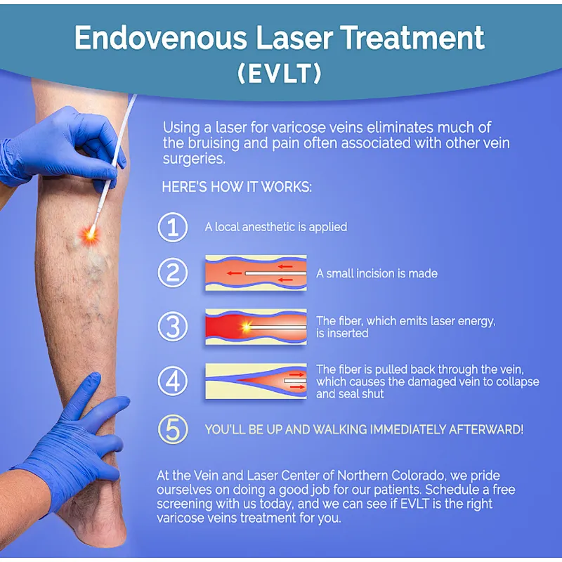 The Newest 980nm Laser  Varicose Veins EVLT EVLA Machine