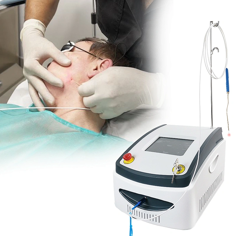 Portable 980nm Diode Laser Liposuction Slimming Machine/ Liposuction Surgical Laser Fiber Lipolysis Machine