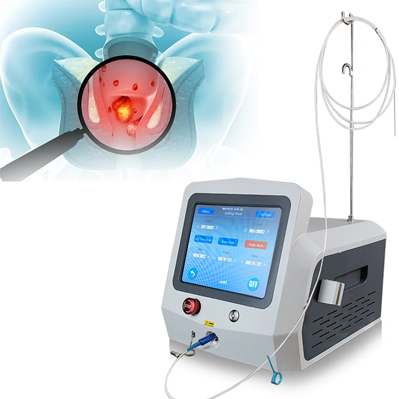 Diode Laser 1470nm Minimally Invasive Proctology Surgery Machine 980nm Removal Anal Fistula Hemorrhoids