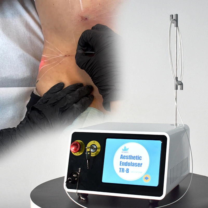 2025 Newest Most Effective Liposuctio And Lipolysis 980nm1470nm Diode Laser  Endolaser Face And Neck Lift Machine