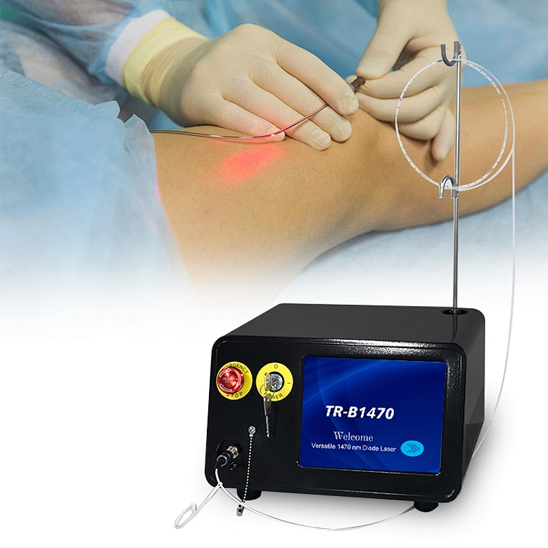 Veins Lazer Treatment Endovascular  Evlt Laser EVLT Machine