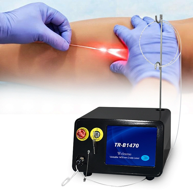 Intravenous Laser Ablation Laser EVLT EVLA  Leg Varicose Veins 1470nm  Laser Machine