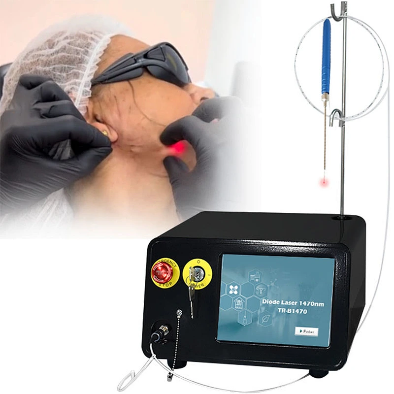 Vaser Liposuction Equipment Diode Laser 1470nm 15W Skin Tightening/Body Shaping Slimming Liposuction Laser Machine