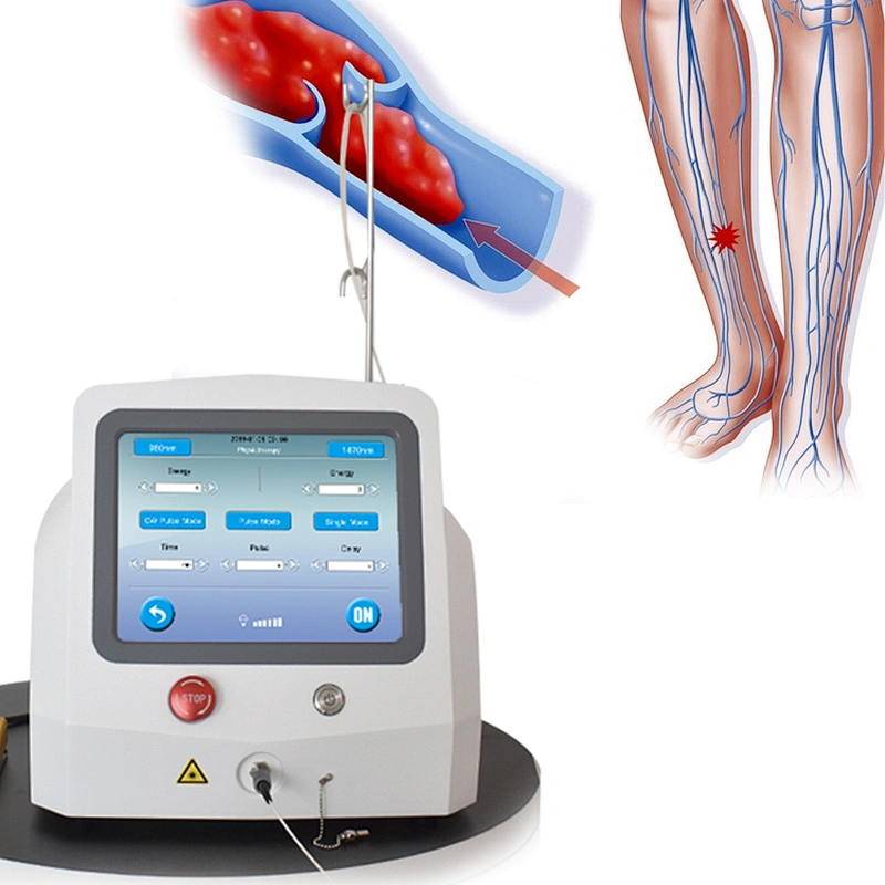 Hot Sale EVLT EVLA  EndoLaser Vein Surgery Endovenous Laser 1470nm Laser Ablation System